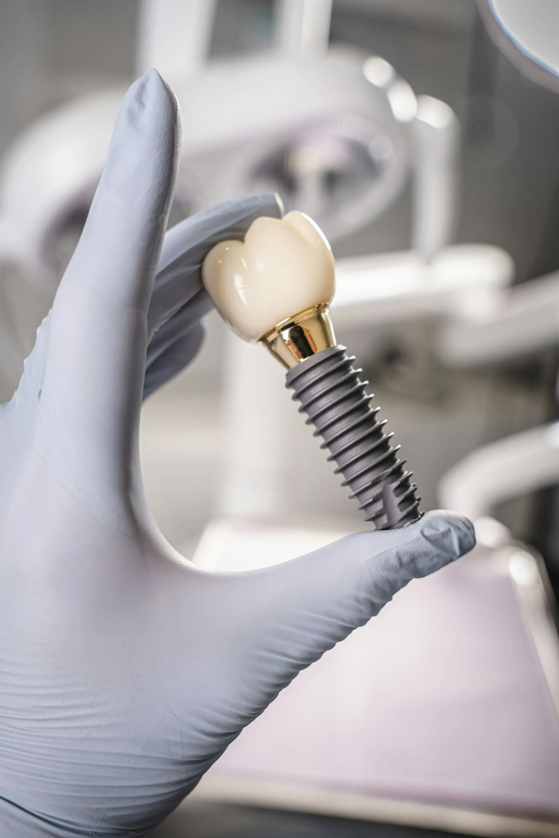 Implant dentar din titan cu coroana montată, ținut între degete