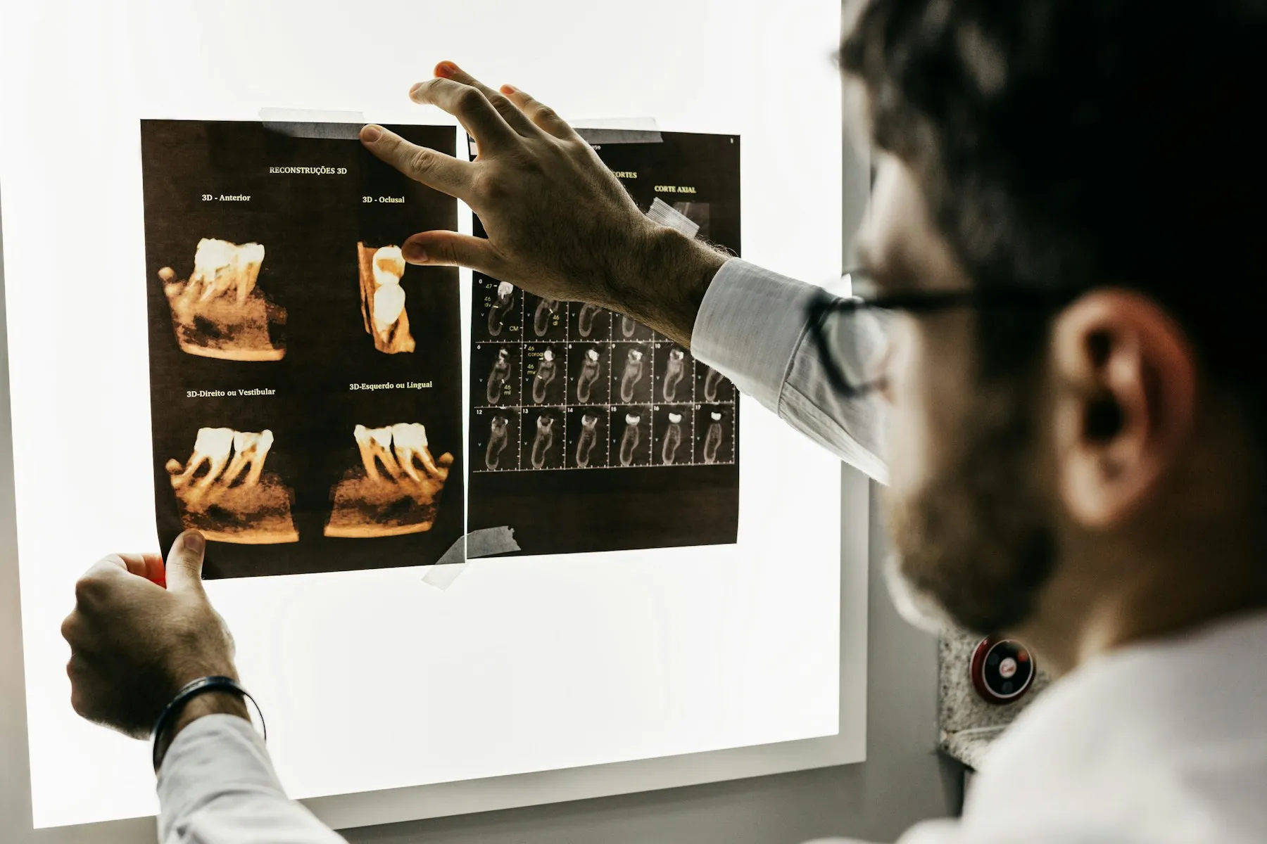Medic care analizează radiografii dentare pe un negatoscop